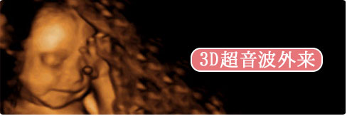 3D超音波外来