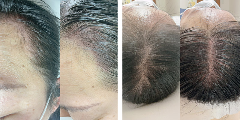 4Dアートメイク